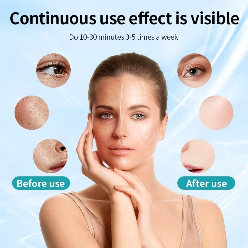 Portable LED Light Therapy Mask